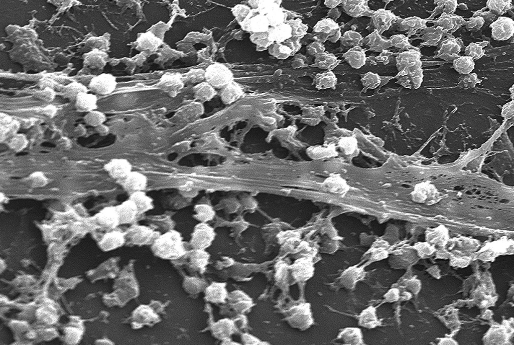 Genetic Modifications You May Not Know About – State of the Planet