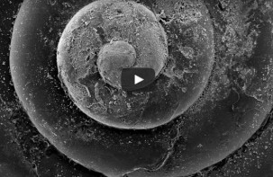 What Is Ocean Acidification & Why Does It Matter?