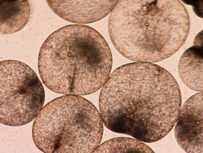 Lily-pad-shaped brown algae cells, magnified under a microscope